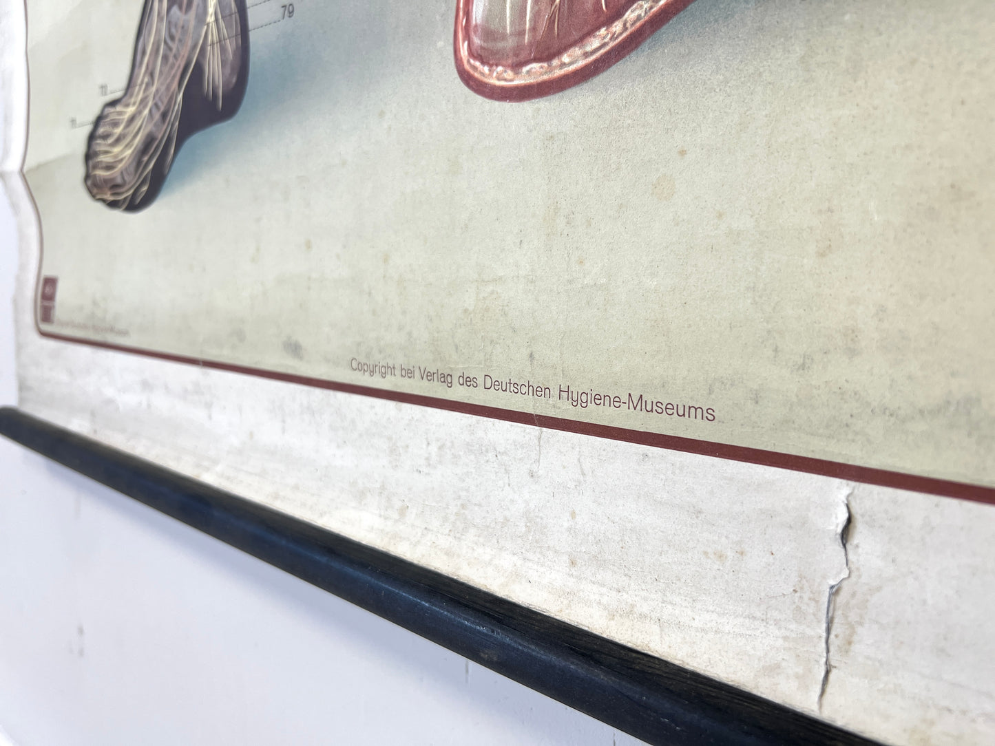 Deutsches Hygiene-Museum, Life Size Nervous System Anatomical Poster