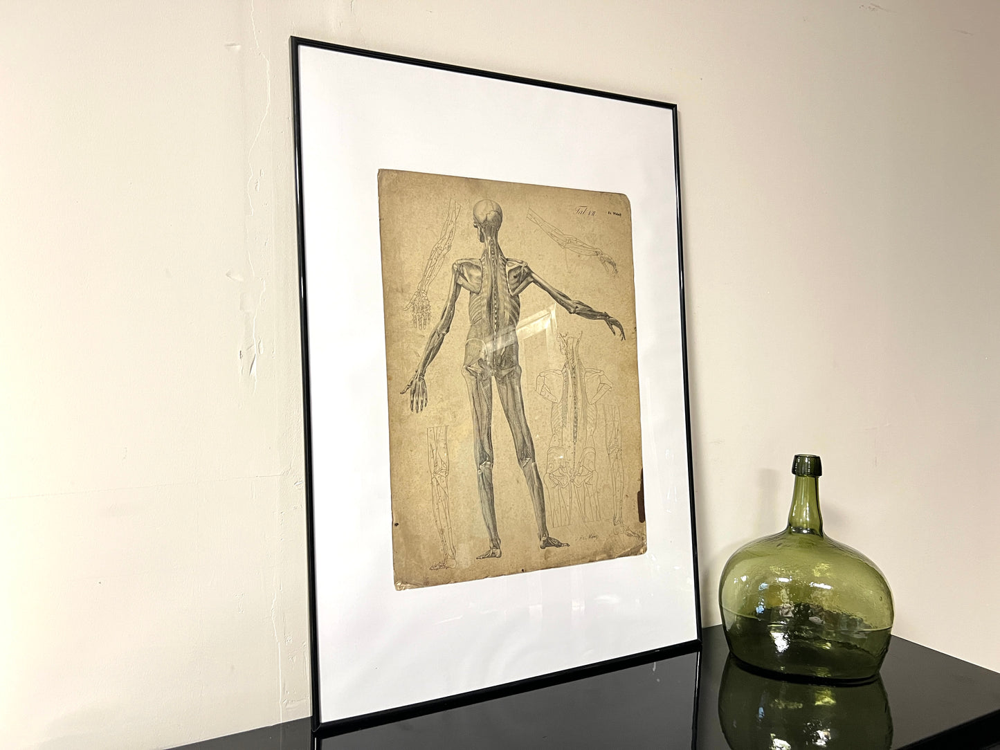 Dr Munz Fecit, A 19th Century Anatomical Etching