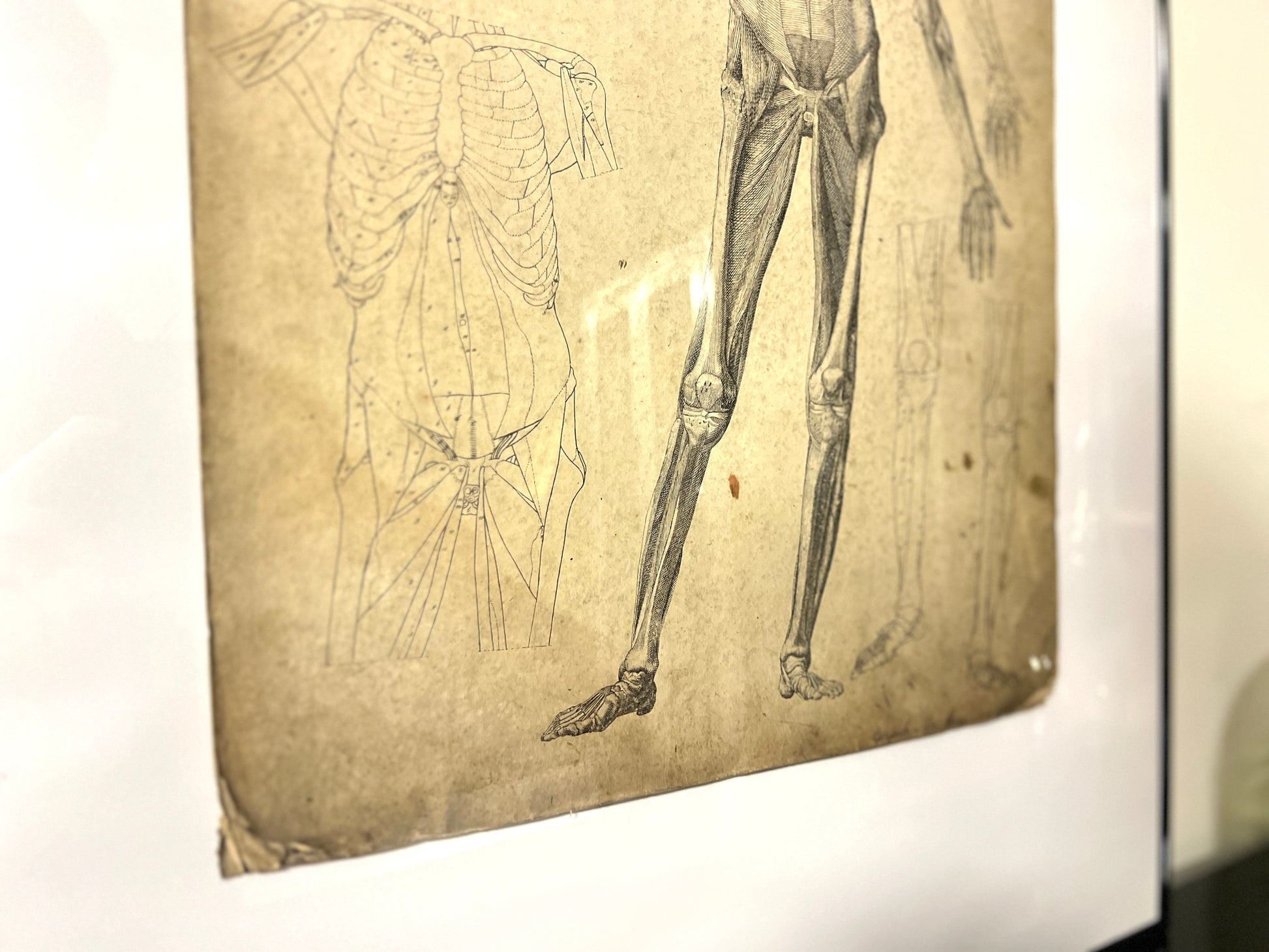 Dr Munz Fecit, A 19th Century Anatomical Etching