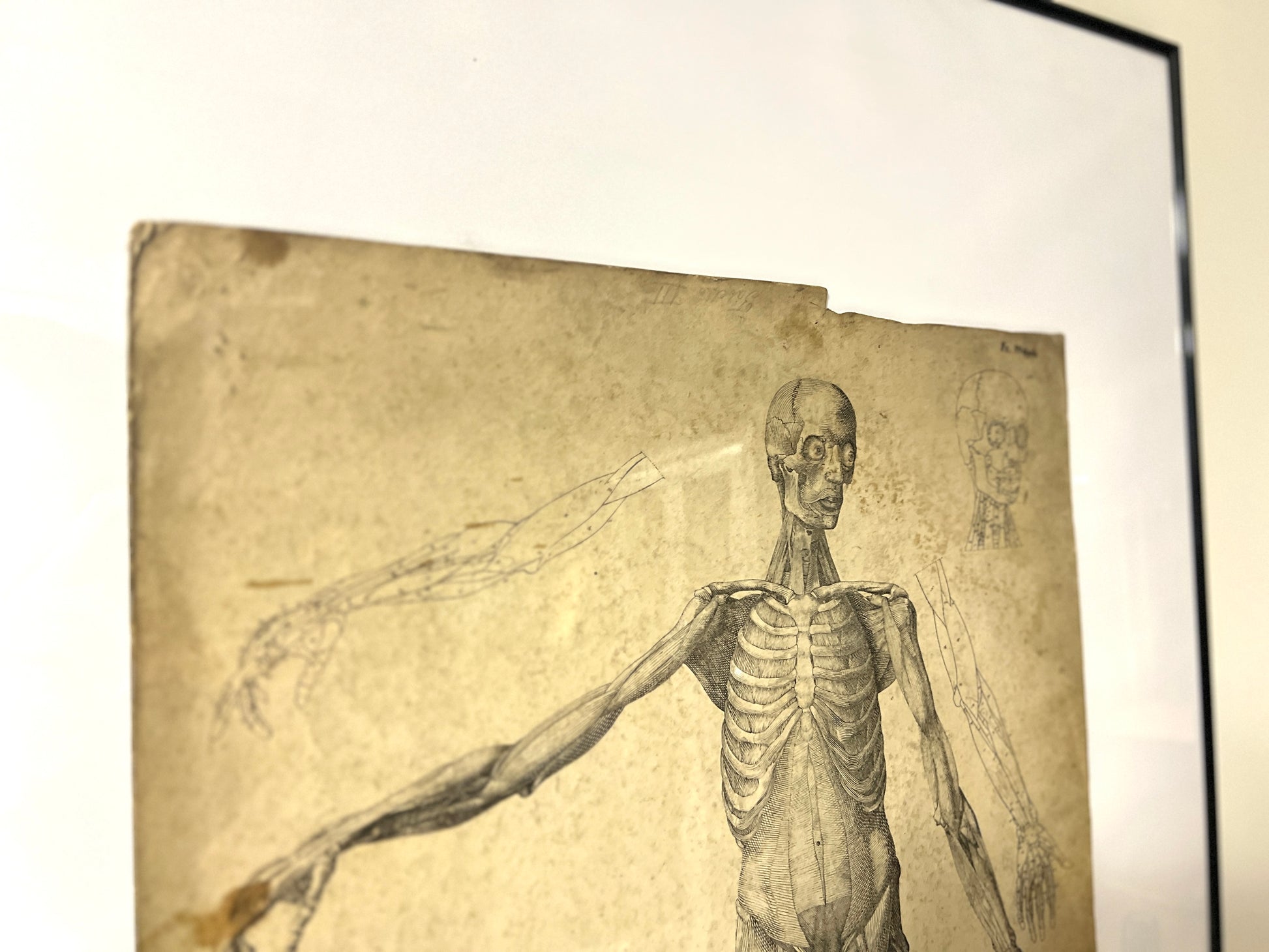 Dr Munz Fecit, A 19th Century Anatomical Etching