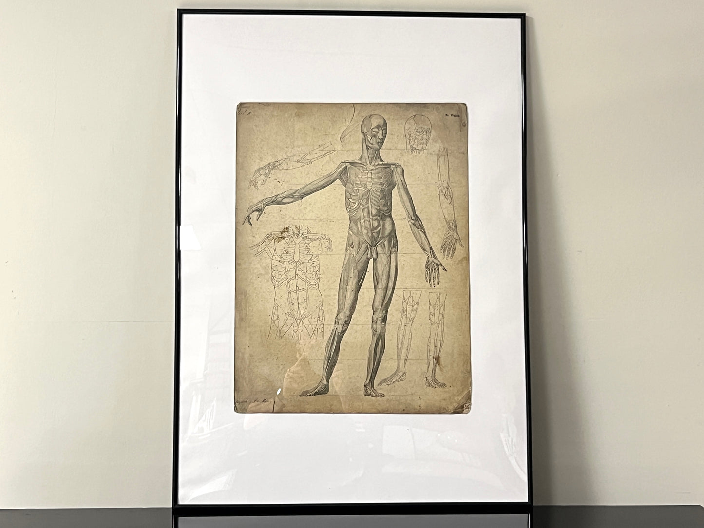 Dr Munz Fecit, A 19th Century Anatomical Etching