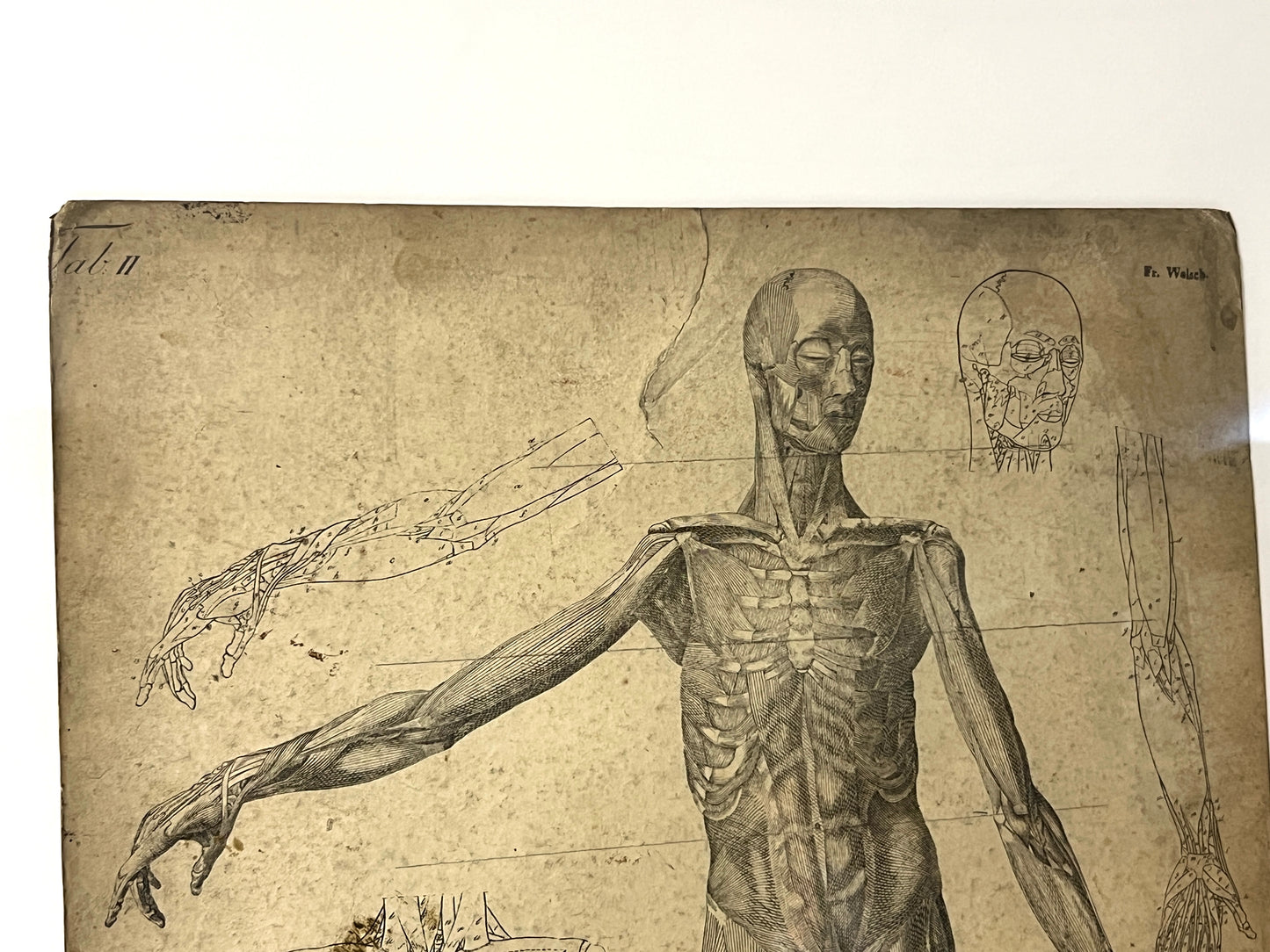 Dr Munz Fecit, A 19th Century Anatomical Etching